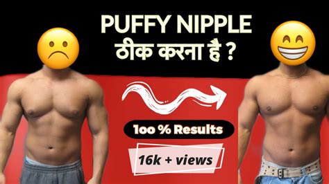 Puffy Nipple ठीक करना है Puffy Nipple Solution 💯 Guaranteed