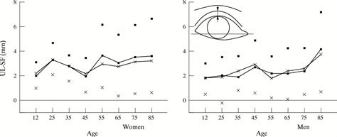 Topographic Anatomy Of The Eyelids And The Effects Of Sex And Age