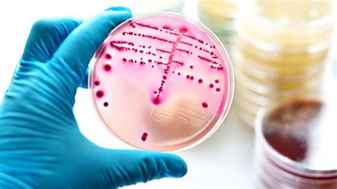 The Different Types Of Streptococcus Everyday Health