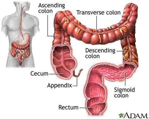 inflammatory bowel disease herbal colon cleanse natural colon