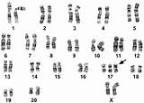 Karyotype Trisomy Baboon Chromosome Nomenclature sketch template