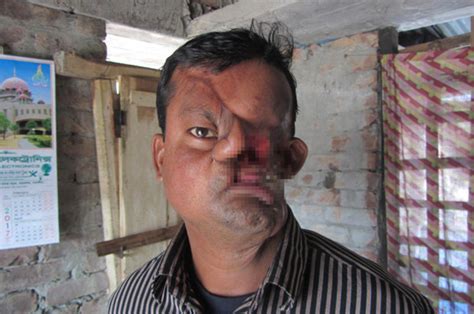 man spends 23 years in hiding after face savagely mauled by tiger