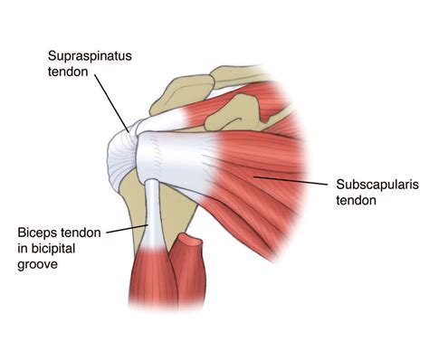 subscapularis shoulder pain