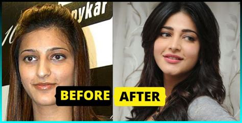 bollywood celebrities   lip surgery   beautiful