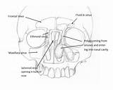 Polyps Nasal Paranasal Sinuses Skull Showing Away Cut sketch template