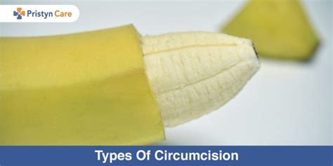 laser circumcision procedure and advantages pristyn care