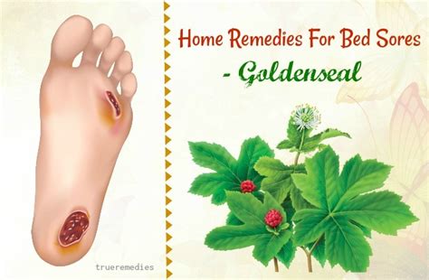 16 Home Remedies For Bed Sores On Elbows Buttocks Knees And Heels