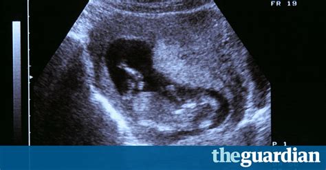 Let’s Talk About Miscarriage Life And Style The Guardian