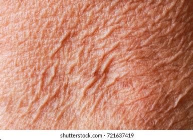 human skin texture images stock  vectors shutterstock