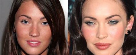 10 Celebs Who Go A Little Overboard On Fillers Megan Fox