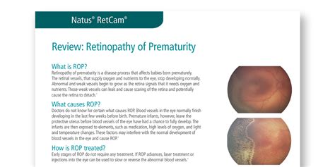 rop review retinopathy  prematurity vision care academy