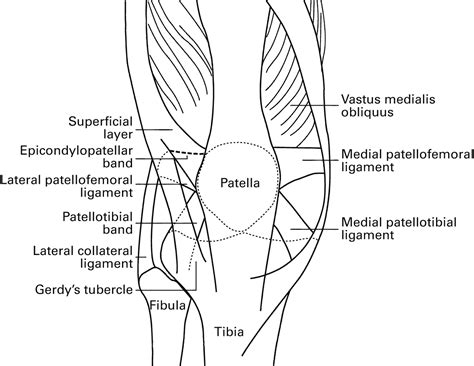 role  lateral retinacular release bone joint