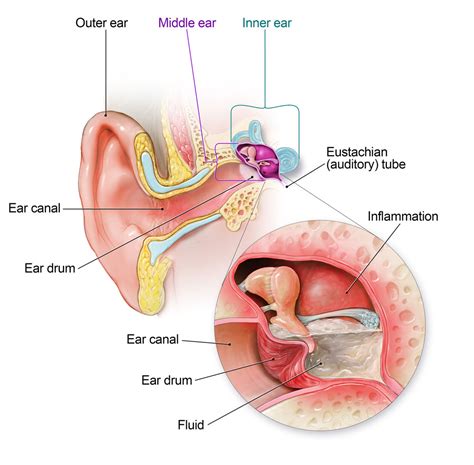 ear infection antibiotic  cdc