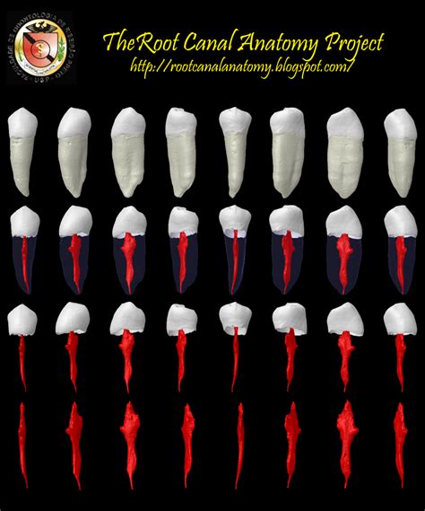 root canal anatomy project mandibular  premolar