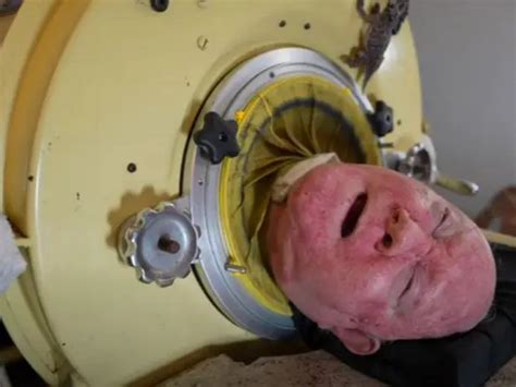 Paul Alexander This Man Has Been Using Iron Lung Machine For Nearly 70