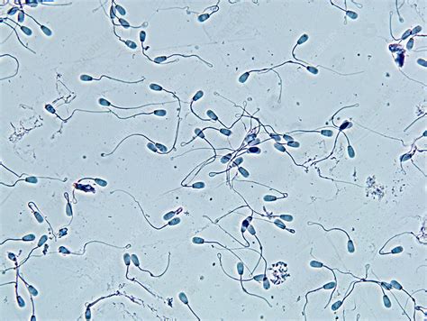 sperm cells stock image p624 0160 science photo library