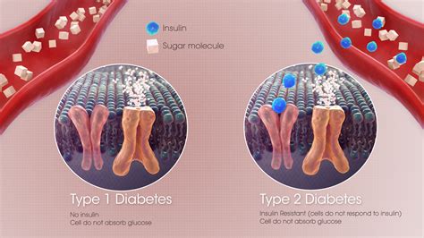 prediabetes   youll  diabetes scientific animations