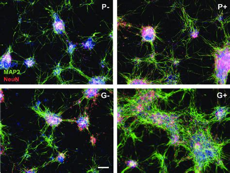expression  mature neuron markers map  neun  div
