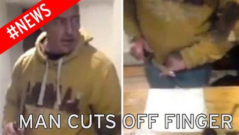 Video Shows Shocking Moment Man Cuts Off His Own Finger Irish Mirror
