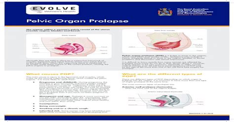 Pelvic Organ Prolapse Evolve Women S Health Separating The