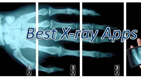 Hilarious X Ray Images