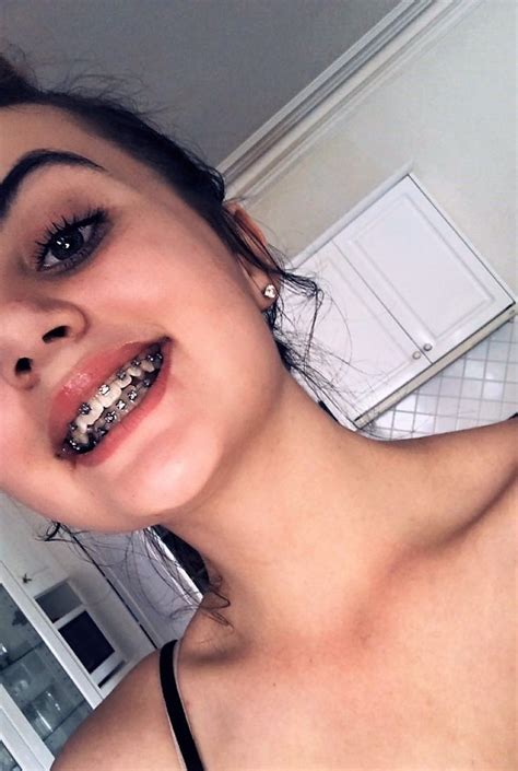 pin by shrood burgos on braces braces girls teeth braces cute braces