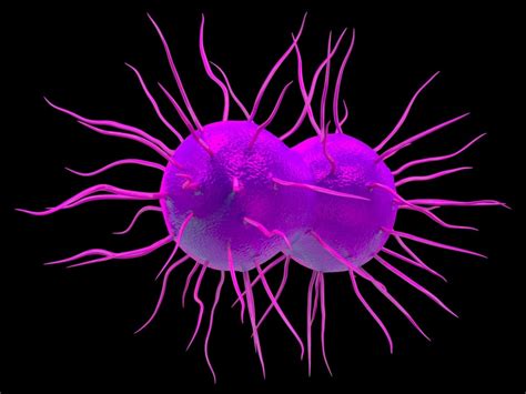 Gonorrhea During Pregnancy Symptoms Treatment And Prevention
