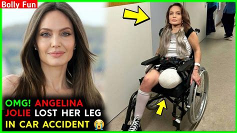 Oh No Angelina Jolie Lost Her Leg Angelina Jolie Accident Youtube