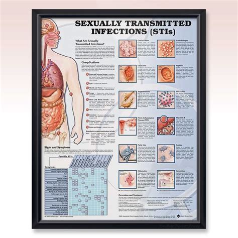 Ob Gyn Sexually Transmitted Infections Human Anatomy Poster Briefly