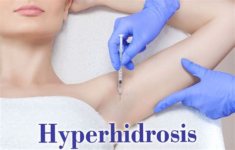 types  hyperhidrosis treatments lucullusrestaurante