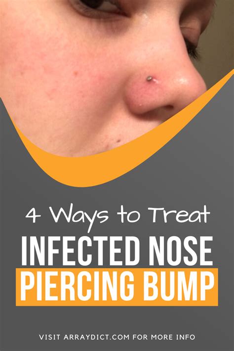 4 things to treat infected nose piercing bump without closing it