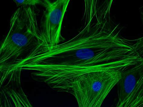 Difference Between Microtubules And Microfilaments Structure