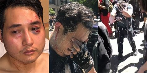 Journalist Andy Ngo Assaulted By Antifa Wielding Assault