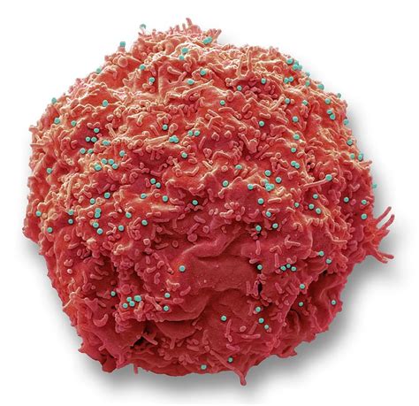 Hiv Infected Cell Photograph By Steve Gschmeissner Science Photo