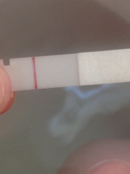 8 And 9dpo Strange Cervical Mucus Tmi Warning Photos Included