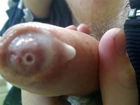 My Dripping Wet Uncut Cock 1 Pics Xhamster