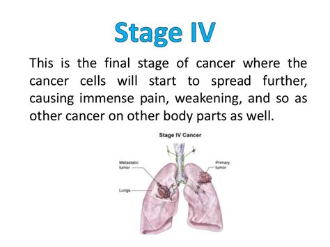 The Stages Of Lung Cancer Caused By Smoking