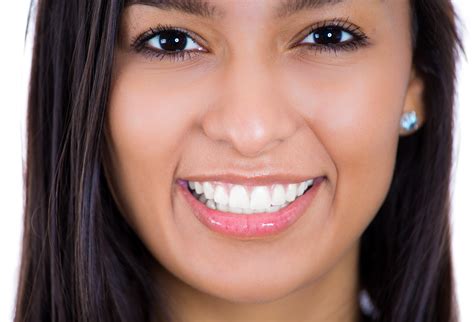 making bigger improvements  professional teeth whitening overland