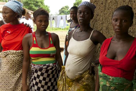 who 10 facts on obstetric fistula