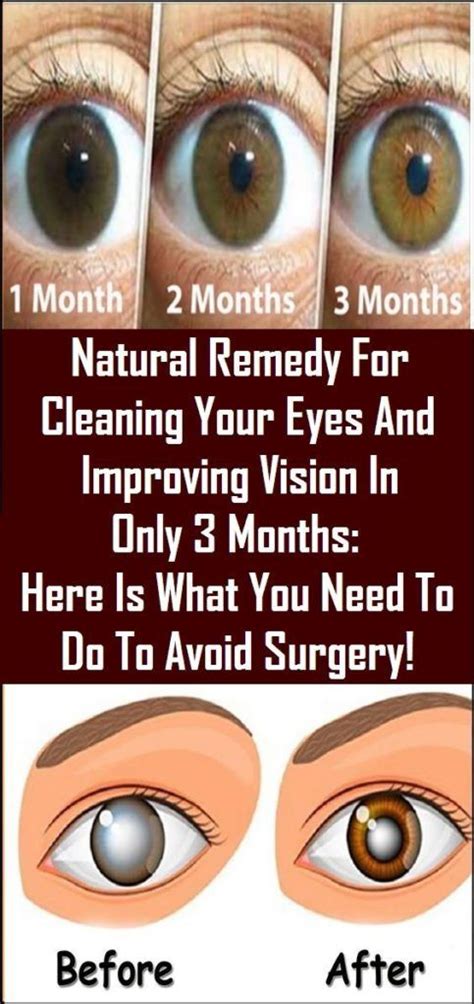 natural remedy  cleaning  eyes  improving vision