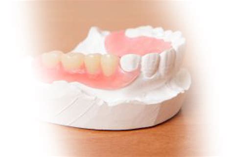 acrylic partial dentures flipper denture calgary