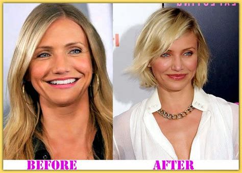 Plastic Surgery Before And After Cameron Diaz Plastic