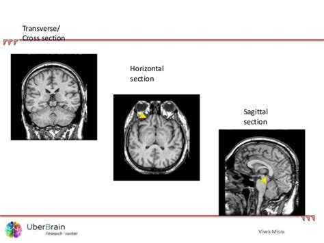 basics of functional neuroanatomy basic function