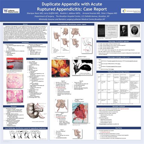 duplicate appendix  acute ruptured appendicitis case report