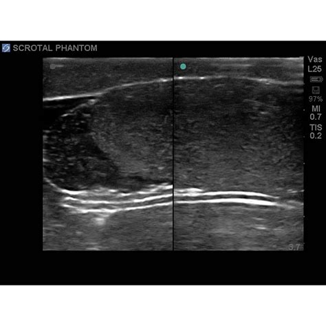 blue phantom scrotal ultrasound training model  cae healthcare  bpp