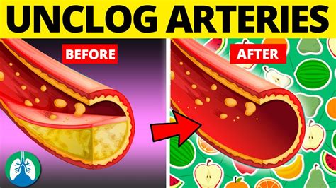 top  foods  clean  arteries   prevent  heart attack