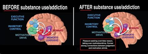 how addiction hijacks the brain effects of addiction florida rehab