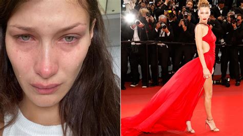 Bella Hadid Opens Up On Her Daily Struggle With Depression And Anxiety