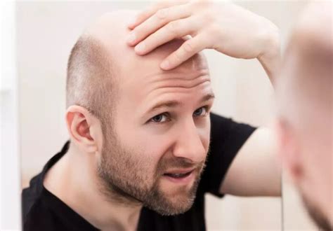 trends  hair loss  treatment fotolog