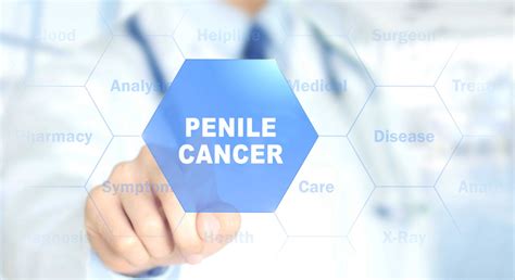 penile cancer dr papazoglou urologist in nicosia cyprus